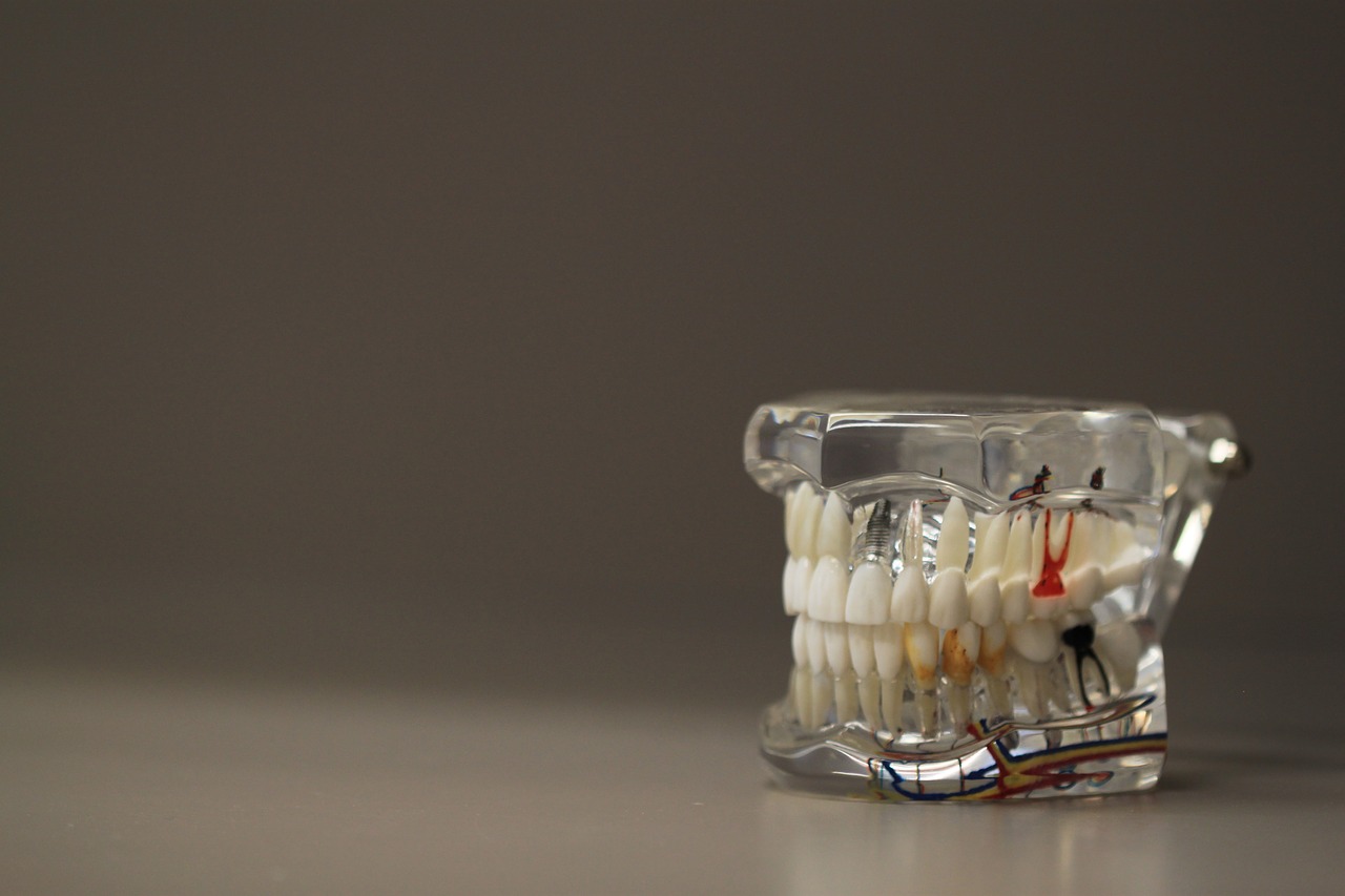 Krzywe zęby – problem estetyczny i zdrowotny